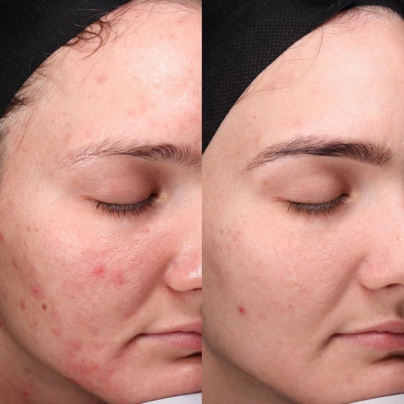 Biojuve Biome Support Complex - LAZ Skincare